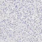 Immunohistochemical staining of human liver shows no positivity in hepatocytes as expected.