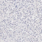 Immunohistochemical staining of human liver shows no positivity in hepatocytes as expected.