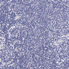 Anti-KRT17 Antibody