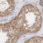 Anti-CCNB3 Antibody