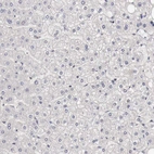 Immunohistochemical staining of human liver shows no positivity in hepatocytes as expected.