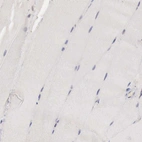Immunohistochemical staining of human skeletal muscle shows no positivity in myocytes as expected.