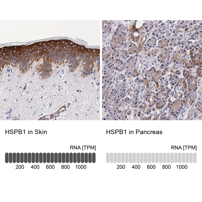 Anti-HSPB1 Antibody
