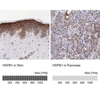 Anti-HSPB1 Antibody
