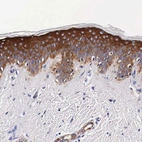 Immunohistochemical staining of human skin shows high expression.