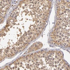 Anti-GNPDA1 Antibody