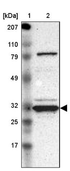 Anti-GNPDA1 Antibody