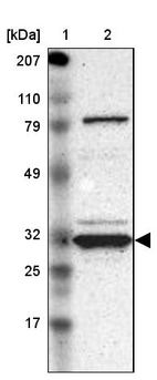 Lane 1: Marker [kDa] 207, 110, 79, 49, 32, 25, 17_br/_Lane 2: Human cell line RT-4