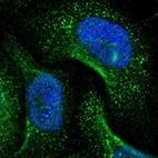 Immunofluorescent staining of human cell line U-251 MG shows localization to vesicles.