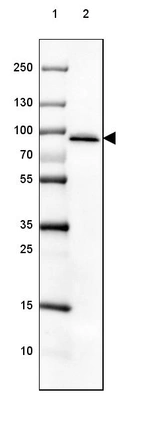 Lane 1: Marker [kDa] 250, 130, 100, 70, 55, 35, 25, 15, 10_br/_Lane 2: Human Adrenal Gland tissue