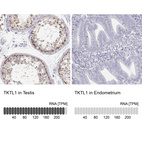 Anti-TKTL1 Antibody
