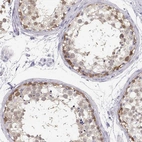 Immunohistochemical staining of human testis shows strong cytoplasmic positivity in spermatogonia.
