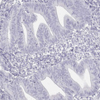 Anti-TKTL1 Antibody