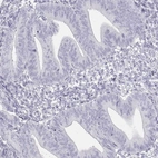 Immunohistochemical staining of human endometrium shows very weak positivity in glandular cells.