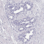 Immunohistochemical staining of human prostate shows very weak positivity in glandular cells.