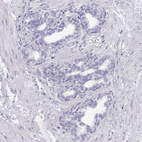 Anti-TKTL1 Antibody