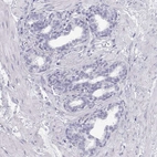 Immunohistochemical staining of human prostate shows very weak positivity in glandular cells.