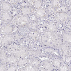 Immunohistochemical staining of human kidney shows no positivity in cells in tubules as expected.