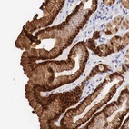 Anti-ITIH6 Antibody