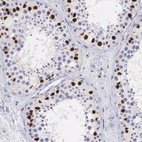 Anti-HMGN5 Antibody