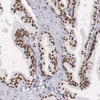 Immunohistochemical staining of human prostate shows strong nuclear positivity in glandular cells.