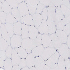 Immunohistochemical staining of human skeletal muscle shows no positivity in myocytes as expected.