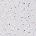 Immunohistochemical staining of human skeletal muscle shows no positivity in myocytes as expected.