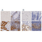 Immunohistochemical staining of human cerebral cortex, colon, kidney and lymph node using Anti-RENBP antibody HPA000522 (A) shows similar protein distribution across tissues to independent antibody HPA000428 (B).