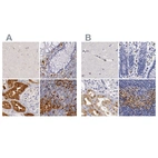 Immunohistochemical staining of human cerebral cortex, colon, kidney and lymph node using Anti-RENBP antibody HPA000522 (A) shows similar protein distribution across tissues to independent antibody HPA000428 (B).