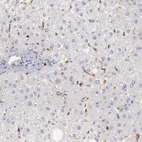 Immunohistochemical staining of human liver shows low expression as expected.