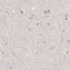 Immunohistochemical staining of human cerebral cortex using Anti-RENBP antibody HPA000522.