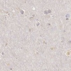 Anti-RENBP Antibody