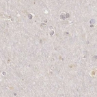 Immunohistochemical staining of human cerebral cortex using Anti-RENBP antibody HPA000522.