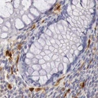 Immunohistochemical staining of human colon using Anti-RENBP antibody HPA000522.
