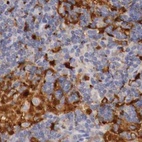 Anti-RENBP Antibody