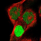 Anti-KCND1 Antibody