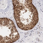 Immunohistochemical staining of human testis shows moderate cytoplasmic positivity in cells in seminiferous ducts.
