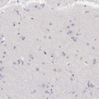 Immunohistochemical staining of human cerebral cortex shows no positivity in neuronal cells.