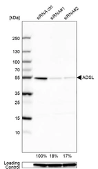 Western blot analysis in U2OS cells transfected with control siRNA, target specific siRNA probe #1 and #2, using Anti-ADSL antibody. Remaining relative intensity is presented. Loading control: Anti-GAPDH.