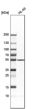 Anti-ADSL Antibody