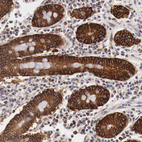 Anti-XPNPEP3 Antibody