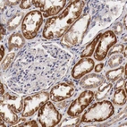 Immunohistochemical staining of human kidney shows strong cytoplasmic positivity in cells in tubules.