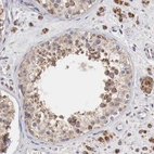 Immunohistochemical staining of human testis shows strong cytoplasmic positivity in spermatids.