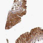 Anti-PITPNB Antibody