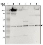 Lane 1: Marker [kDa] 219, 112, 85, 49, 32, 25, 18_br/_Lane 2: Human cell line RT-4_br/_Lane 3: Human cell line U-251MG sp_br/_Lane 4: Human cell line A-431_br/_Lane 5: Human liver tissue_br/_Lane 6: Human tonsil tissue