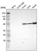 Western blot analysis in human cell line RT-4, human cell line U-251 MG, human cell line A-431, human liver tissue and human tonsil tissue.