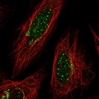 Immunofluorescent staining of human cell line SiHa shows localization to nuclear bodies & the Golgi apparatus.