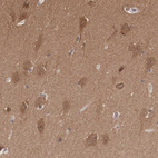 Anti-PDXP Antibody