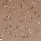 Anti-PDXP Antibody