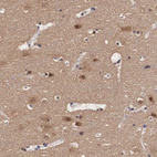 Immunohistochemical staining of human cerebral cortex shows moderate to strong positivity positivity in neurons and neuropil.